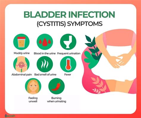 cistiti burberry|Bladder Inflammation (Cystitis): Causes, Symptoms, and .